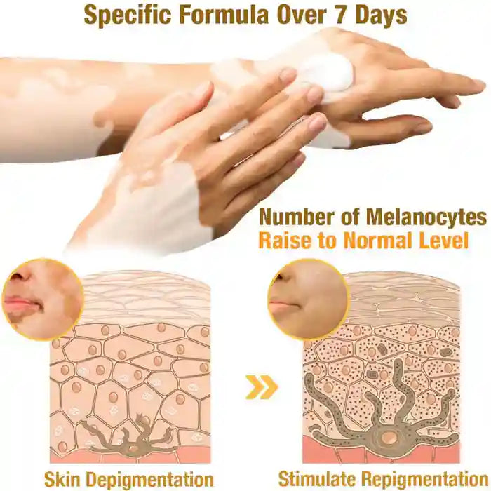 New Revitalizing Bee Venom Cream Natural Skin Restoration. Buy 1 - Get 2 Free