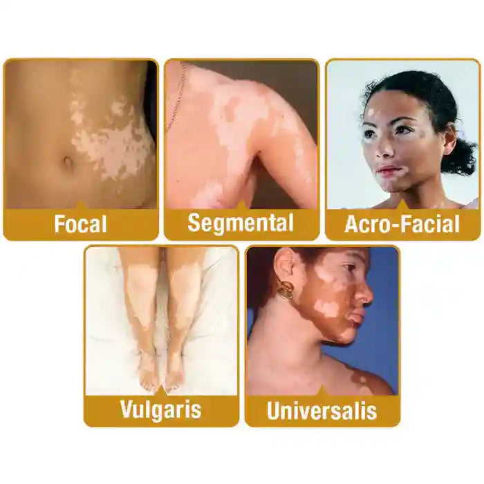 New Revitalizing Bee Venom Cream Natural Skin Restoration. Buy 1 - Get 2 Free