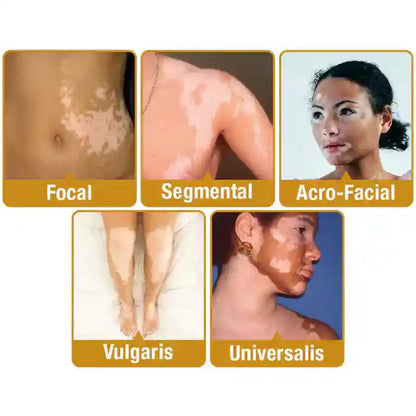 New Revitalizing Bee Venom Cream Natural Skin Restoration. Buy 1 - Get 2 Free